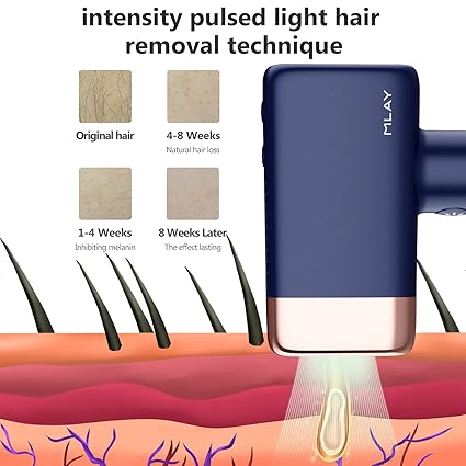 MLAY IPL Hair Removal Device, Ice Cooling Protection Laser Permanent Whole Body Hair Remover for Home Use Women and Men (Bule)