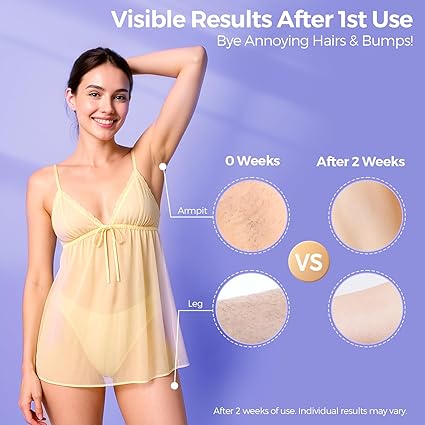 Laser Hair Removal with 5℃ Ice Cooling, Painless IPL Laser Hair Removal Device for Women & Men, 999,999 Flashes, 5 Levels, 2 Modes, Permanent At-Home Hair Removal for Face & Body, with 3 in 1 Set